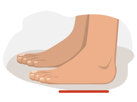 Illustration of flat feet