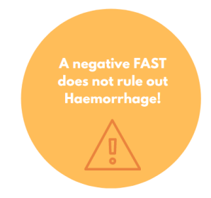 A negative FAST does not rule out haemorrhage!