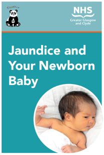 Jaundice and your newborn baby patient information