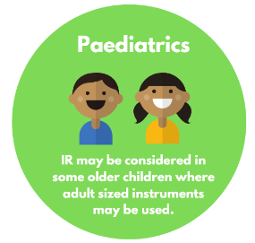 Paediatrics - IR may be considered in some older children where adult sized instruments may be used.