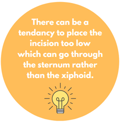 There can be a tendency to place the incision too low which can go through the sternum rather than the xiphoid.
