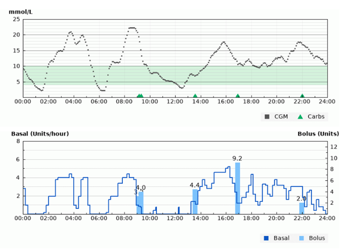 Diasend screenshot showing “see-saw” pattern from overtreatment of hypos.