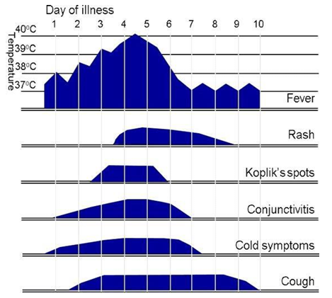 Clinical course of primary measles infection graph