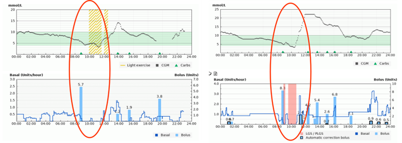 Diasend screenshot showing system shutting off to prevent hypos.