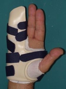 Hand splint