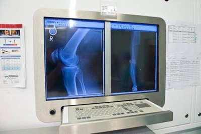 An X-ray